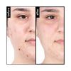 pH-In 3 Step Healthy Skin System