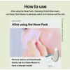 [ILSO]Deep clean master Blackhead Remover Tool Exfoliator 9.5cmx4cm K-Beauty