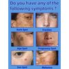 Nicotinamide Freckles Removing Cream
