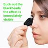 80 Pcs Blackhead Remover Strips - Bamboo Charcoal Deep Cleansing Pore Strips for Blackheads, Nose Blackhead Remover Strips, Blackhead Removal Nose Pore Strips for Women Men (Black)