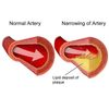 Advanced cardiovascular support-CHOLESTEROL RELIEF- Reduces LDL Cholesterol - 60