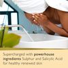 Revitale Advanced Salicylic Acid & Sulphur Scrub Treatment Soap