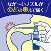 [Third drug class] Nodonuru Nytect 15ml