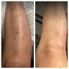 Body Bleaching Cream Max Strength Whitening Lightening AHA