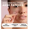 WUNDERTAPE Acne Patches, Anti-Pimple Patch (Pack of 80)