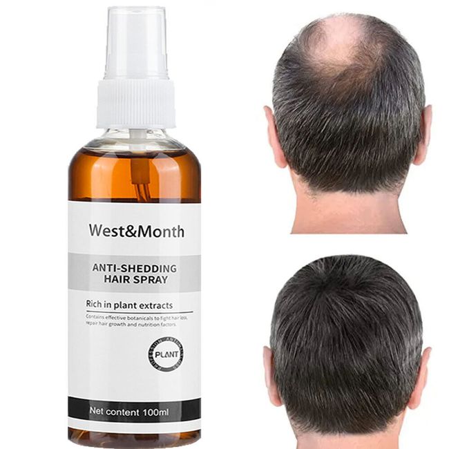 Anti Hair Loss Growth Liquid Spray Hair Growth Serum Spray Scalp Repair 100ML