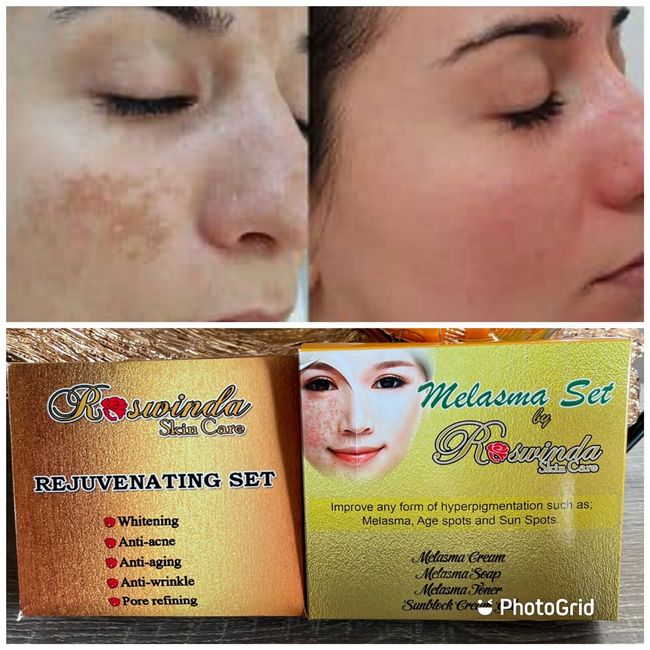 Dr. Alvin PSCF Rejuvenating Set And Melasma Set Treatment For Dark Pimples Spot