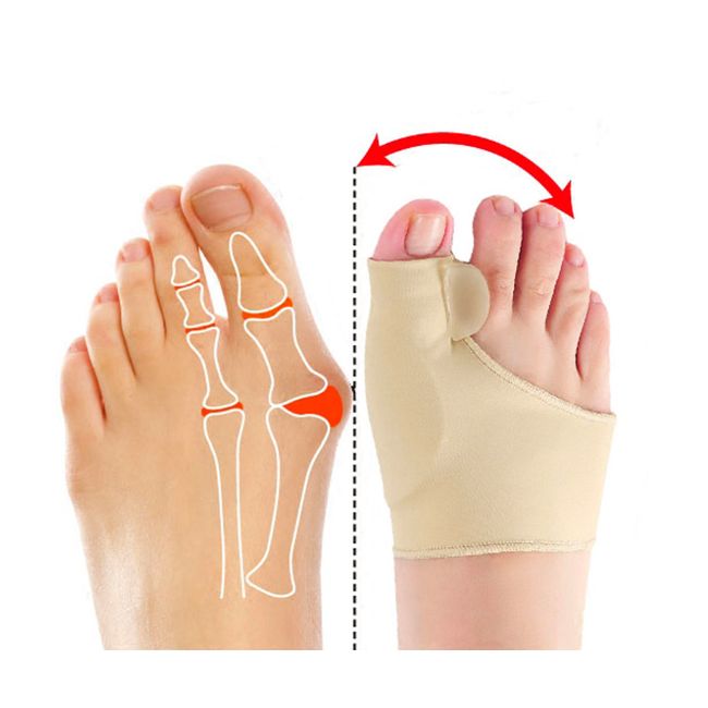 1 Pair Big Toe Bunion Splint Straightener Corrector Hallux Valgus Pain Relief US