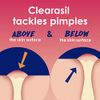 Clearasil Rapid Rescue Deep Treatment Acne Face Pads, Maximum Strenght with 2% Salicylic Acid Acne Treatment Medicine, 90 Count