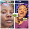 Skin Whitening Face Cream