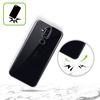 Head Case Designs Smooth Fox Terrier Dog Breed Patterns 13 Soft Gel Case Compatible With Nokia X30