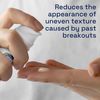 Cetaphil Gentle Clear Repairing Post Acne Serum