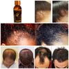 Ultimate Hair Growth Serum 