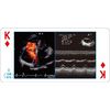Fun Learning with Playing Cards, ECG and Echocardiogram