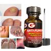 Nail Fungus Support Solution For Toe & Fingers Maximum Strength Aloe Vera kit