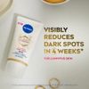 NIVEA LUMINOUS 630 Anti Dark Spot Advanced Hand Cream (50ml), Skin Cream Enriched With Hyaluronic Acid, Nourishing Hand Cream For Luminous Skin