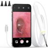 Otoscope 3.9mm Ultra-Thin Ear Camera with 6 LED Lights for iPhone 15/for Android