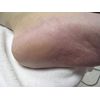 Footlogix Cracked Heel Formula 125ml