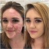 Glamza Phoera Foundation Full Coverage Makeup Set - 24hr Long Lasting Oil Control - Soft Smooth Matte Flawless Concealer Cream - Inc x10 30ml Foundation & Silicone Blender Sponge (103 Warm Peach)