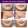 V-Line Lifting Band Facial Lift Patch