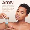 Ambi Even & Clear Fade Cream, Hyperpigmentat