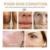 2Pack Turmeric Dark Spot Corrector Serum, Natural Turmeric Repair Face Serum for Face Melasma, Hydrate Dull and Dry Skin