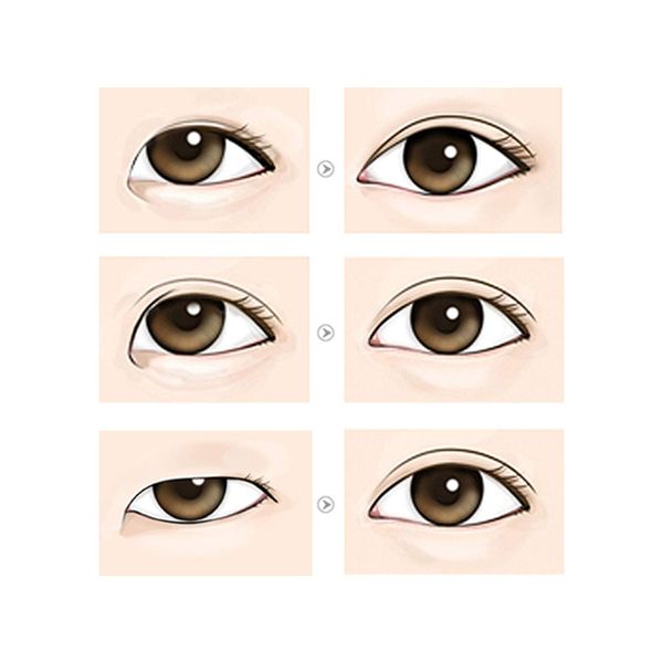 Eye Charm Queen Double Eyelid Tape 50 pairs