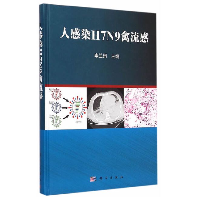 人感染H7N9禽流感