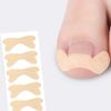 Ingrown Toenail Correction Protection Tape Band Toenail Trimming, Ingrown Toenail Correction Band 30P