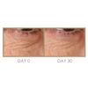 GENIE H'eye'drator PLUS Eye Cream