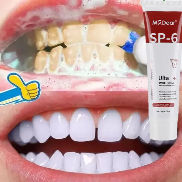 Sp-6 Probiotic Whitening Toothpaste Brightening & Bad Breath Removing Toothpaste