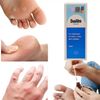1 X DUOFILM Solution 15ml Treatment Remove Warts Corns Calluses + FAST SHIPPING