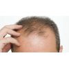 dht blocker with immune support - DHT BLOCKER HAIR COMPLEX - zinc for men 2B