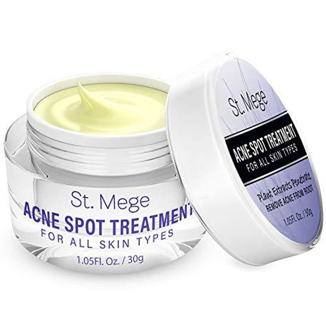 Acne Whitening Cream by St.Mege - Penetrate to Treat Acne from Root, Moisturizing Spot Treatment