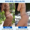 LURE Essentials Sculpt Cupping Set for Cellulite, Lymphatic Drainage Anti Cellulite Cup and Cellulite Massager