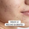 BeOnMe: Face Spot Treatment 15 ml