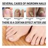 Ingrowth Toenail Correction Treatment Oil, Ingrown Toenail Treatment Kit, Correction Ingrown Toenail Drops, Cuticle Nail Oil Nail Fungal Treatment for Ingrown Toenail, with Glass Nail File