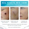 Advanced High-Potency Silicone Scar Gel with Vitamin E for Old, New Scars, Surgery, Keloids, Burns, and Facial Blemish Scars, NewGel Plus by MyNewGel (15 Grams) - 0.50 oz
