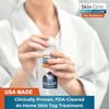 FDA-Cleared Cryo Skin Tag Remover – Quick Treatment with Applicators