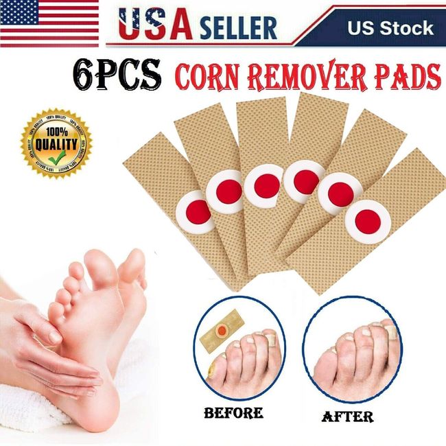 Foot Corn Removal Medical Plaster Foot Pad Patch Dead Skin Callus Remover Relief