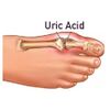 Support Prostate Health - Uric Acid Formula 1430mg - Cranberry Extract 3B