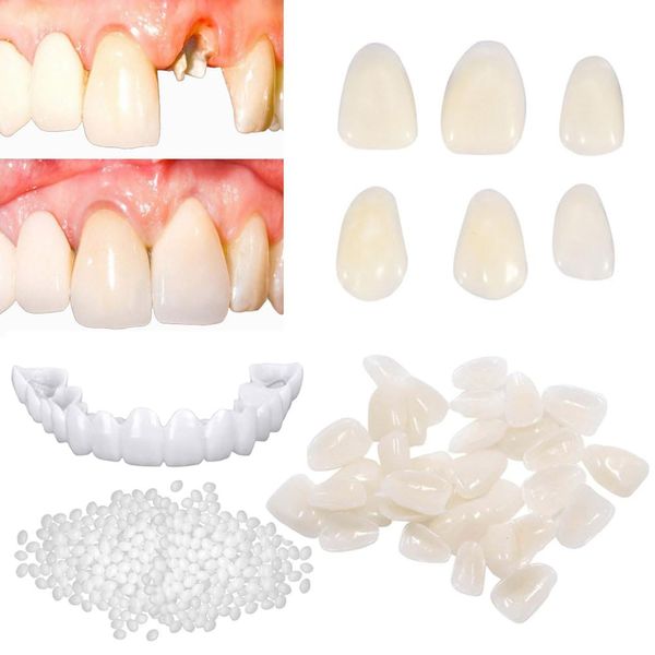 Tooth Repair Kit for Fixing the Missing Chipped and Broken Tooth Gap Temporary Replacement Thermal Beads and Fake Teeth Brace Mold