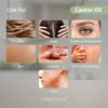 Dermavitamins 100% Pure Castor Oil - 30ml