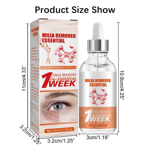 Speedy Milia Remover,Milia Remover,Milia Remover Under Eyes,Milia Spot Serum for Face,Helps Dissolve and Reduce Milia,Dark Spot Remover,to Reduce Milia, Dark Circles Under Eye for Women & Men