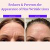 BLUMBODY Face & Forehead Wrinkle Patches - Anti Wrinkle Facial Patches to Smooth Eye, Mouth, Forehead Wrinkles - Non-Silicone Face Tape for Fine Wrinkles between Eyes & Face - Patches (30 day supply)