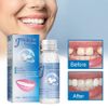 Temporary Tooth Repair Kit Temp Dental Repair Replace Missing Teeth DIY Moldable