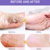 Foot Care Mask