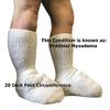 Bariatric Sock for Extreme Lymphedema Calf stretches to 30" (Black)