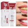 SP-6 Probiotic Whitening Toothpaste Refresh Mouth Brighten Remove Yellow Tooth