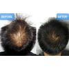 DAMO hair loss control scalp Tonic